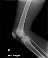 QTK Knee 06-2014