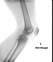 CAK Knee 03-2015